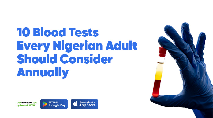 10 BLOOD TEST EVERY NIGERIAN SHOULD HAVE ANNUALLY.